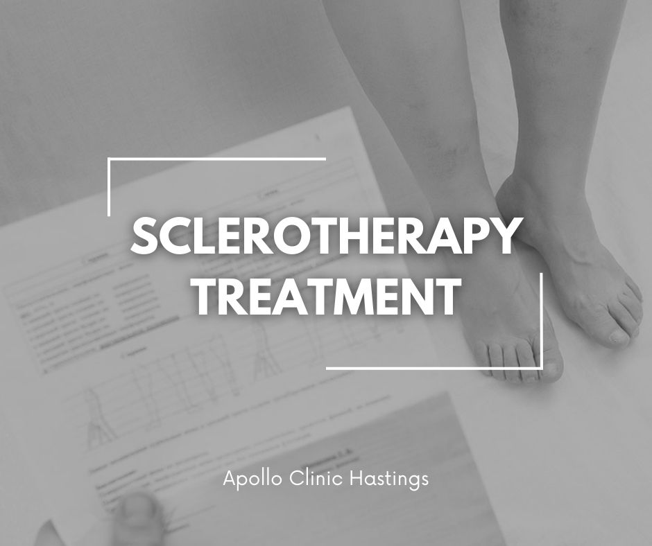 SCLEROTHERAPY TREATMENT